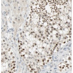 Methyltransferase Like Protein 6 (METTL6) Antibody