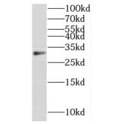 WB analysis of HeLa cells, using METTL6 antibody (1/300 dilution).