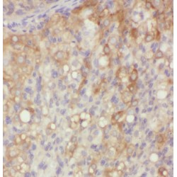 Microfibrillar Associated Protein 4 (MFAP4) Antibody