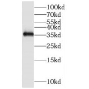 WB analysis of human kidney tissue, using MFAP4 antibody (1/600 dilution).