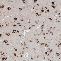 Mitochondrial Fission Factor (MFF) Antibody