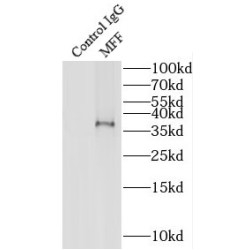 Mitochondrial Fission Factor (MFF) Antibody