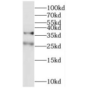 WB analysis of human brain tissue, using MFF antibody (1/1000 dilution).