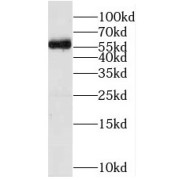 WB analysis of mouse liver tissue, using MFSD8 antibody (1/1000 dilution).