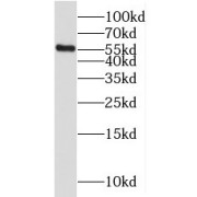 WB analysis of human liver tissue, using MGAT2 antibody (1/500 dilution).