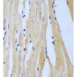 Beta-1,4-Mannosyl-Glycoprotein 4-Beta-N-Acetylglucosaminyltransferase (MGAT3) Antibody