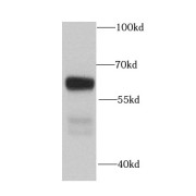 WB analysis of COLO 320 cells, using MGAT3 antibody (1/1000 dilution).