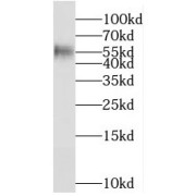 WB analysis of SH-SY5Y cells, using MGAT4C antibody (1/300 dilution).