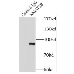 Mannosyl (Alpha-1,6-)-Glycoprotein Beta-1,6-N-Acetyl-Glucosaminyltransferase, Isozyme B (MGAT5B) Antibody