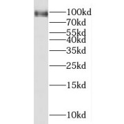 WB analysis of HepG2 cells, using MGAT5B antibody (1/500 dilution).