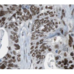 Protein O-GlcNAcase / MGEA5 (OGA) Antibody