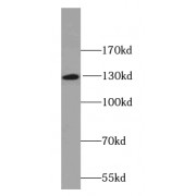 WB analysis of Human brain lysate, using MGEA5 antibody (1/600 dilution).