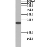 WB analysis of Jurkat cells, using MGMT antibody (1/1000 dilution).