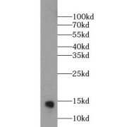 WB analysis of human brain tissue, using MGP antibody (1/1000 dilution).