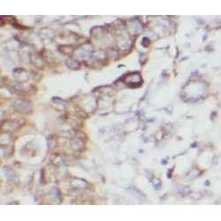 MHC Class I Polypeptide Related Sequence B (MICB) Antibody