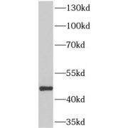 WB analysis of Transfected HEK-293 cells, using MICB antibody (1/3000 dilution).