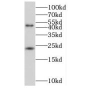 WB analysis of HEK-293 cells, using MID1IP1 antibody (1/300 dilution).