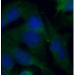 Macrophage Migration Inhibitory Factor (MIF) Antibody