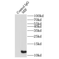 Macrophage Migration Inhibitory Factor (MIF) Antibody