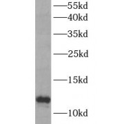WB analysis of Y79 cells, using MIF antibody (1/1000 dilution).
