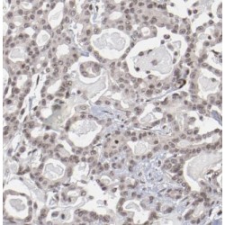 MYC Induced Nuclear Antigen (MINA) Antibody