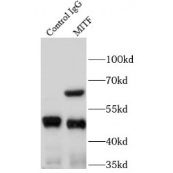 Melanogenesis Associated Transcription Factor (MITF) Antibody