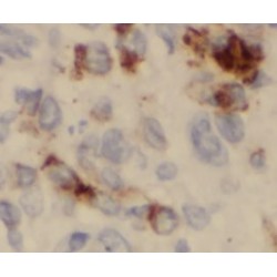 MICOS Complex Subunit MIC60 (IMMT) Antibody