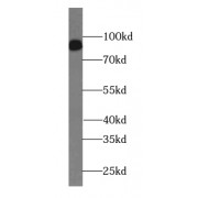 WB analysis of HeLa cells, using IMMT antibody (1/1000 dilution).