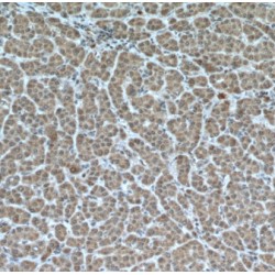 Meckel Syndrome Type 1 Protein (MKS1) Antibody