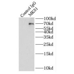 Meckel Syndrome Type 1 Protein (MKS1) Antibody