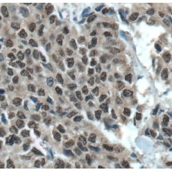 Myeloid Leukemia Factor 1 (MLF1) Antibody