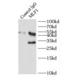 Myeloid Leukemia Factor 1 (MLF1) Antibody