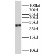 WB analysis of mouse heart tissue, using MLF1 antibody (1/500 dilution).