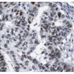 DNA Mismatch Repair Protein Mlh1 (MLH1) Antibody