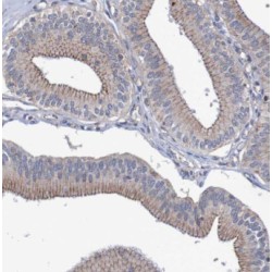 Mixed Lineage Kinase 2 (MLK2) Antibody