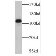 WB analysis of human skeletal muscle tissue, using MAP3K10 antibody (1/300 dilution).