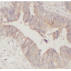 Mixed Lineage Kinase 3 (MLK3) Antibody