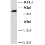 WB analysis of PC-3 cells, using MLK3 antibody (1/500 dilution).