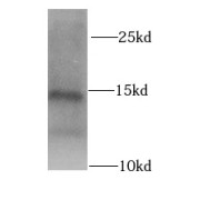 WB analysis of MCF7 cells, using MLN antibody (1/1000 dilution).