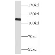 WB analysis of A2780 cells, using MLN51/CASC3 antibody (1/500 dilution).