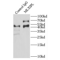 Carbohydrate-Responsive Element-Binding Protein (MLXIPL) Antibody