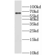 WB analysis of HepG2 cells, using MLXIPL antibody (1/1000 dilution).