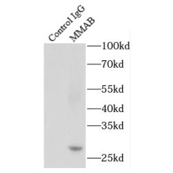 Methylmalonic Aciduria Type B Protein (MMAB) Antibody