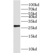 WB analysis of HeLa cells, using MMAB antibody (1/300 dilution).