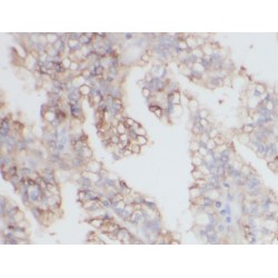 Neprilysin / NEP (MME) Antibody