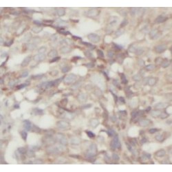 Matrix Metalloproteinase 13 (MMP13) Antibody