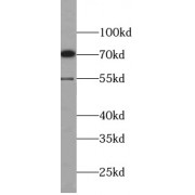 WB analysis of MCF7 cells, using MMP13 antibody (1/600 dilution).