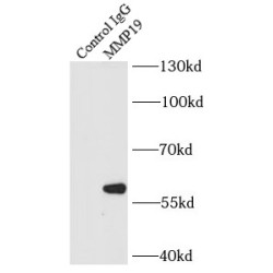Matrix Metalloproteinase 19 (MMP19) Antibody