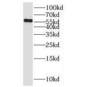 WB analysis of SH-SY5Y cells, using MMP19 antibody (1/300 dilution).