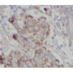 Matrix Metalloproteinase 2 (MMP2) Antibody